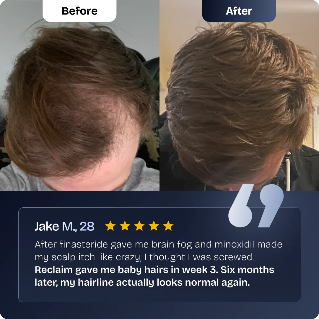 Reclaim Hair Growth Peptides